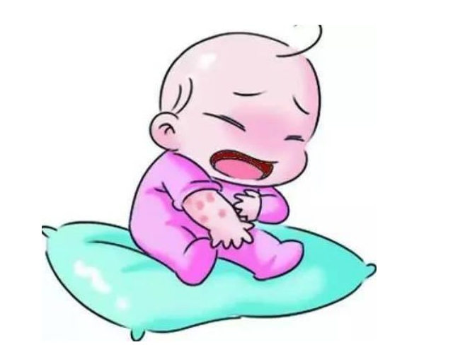 中医药膳帮你治疗湿疹