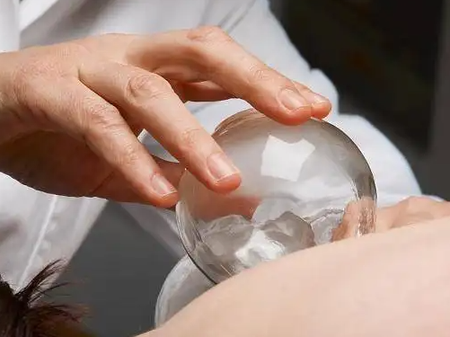 中医拔罐减肥有什么副作用吗 拔罐减肥有坏处吗