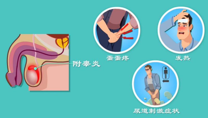 男人防治附睾炎的药膳法宝