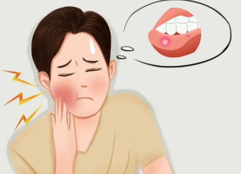 口腔溃疡怎么办 口腔溃疡的饮食调养方法