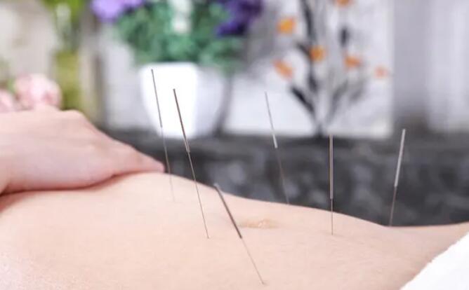 针灸拔罐减肥的方法(中医针灸拔罐减肥)
