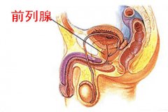 前列腺癌的发病跟哪些因素有关？
