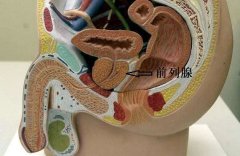 什么是湿热型前列腺炎？专家介绍湿热型前列腺炎的含义！
