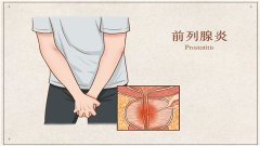 阴囊潮湿是怎么回事？3个方法让你恢复男性雄风！