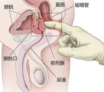延缓射精训练方法，八种延缓射精