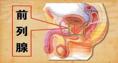 前列腺针灸穴位，针灸治疗前列腺