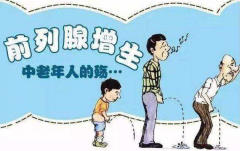 前列腺增生的症状勿忽视，前列腺