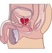 自己取前列腺液的方法，教你正确