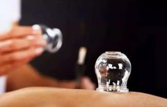 中医拔罐减肥常识及注意事项！