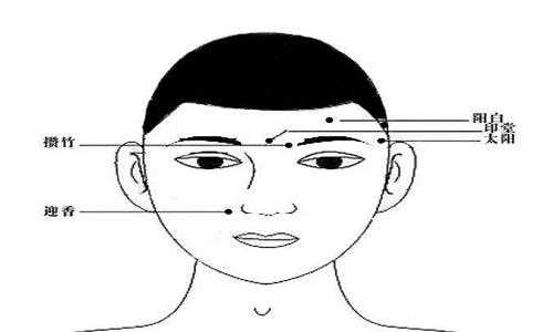  面瘫艾灸