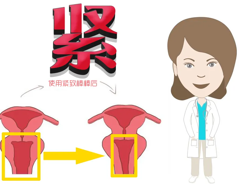 什么缩阴产品最好最快,99的女人都想知道