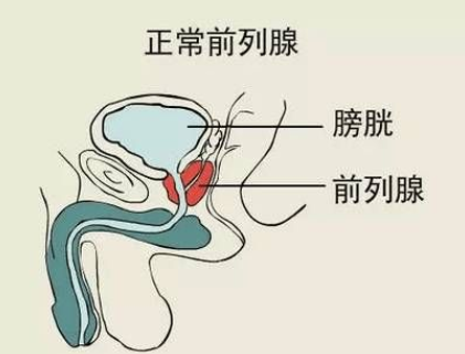 男人前列腺按摩的好处是什么？