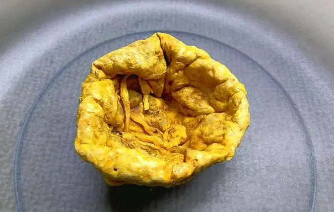 紫河车对男人的功效与作用，男人