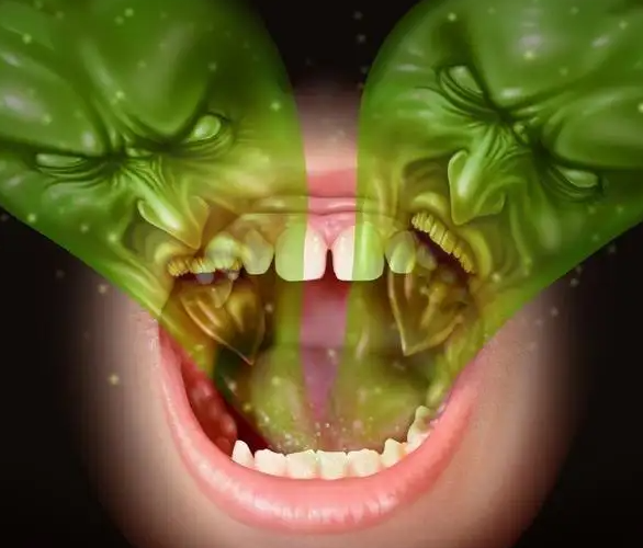 详解口臭形成的原因及治疗方法！