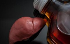 乙肝患者过性生活前应做什么准备