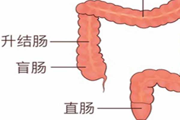 慢性结肠炎治疗方法