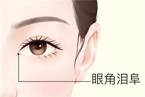 为什么会泪失禁