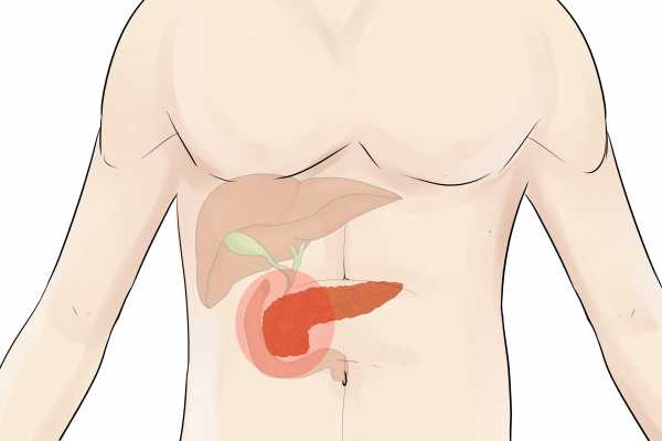 什么是慢性胰腺炎