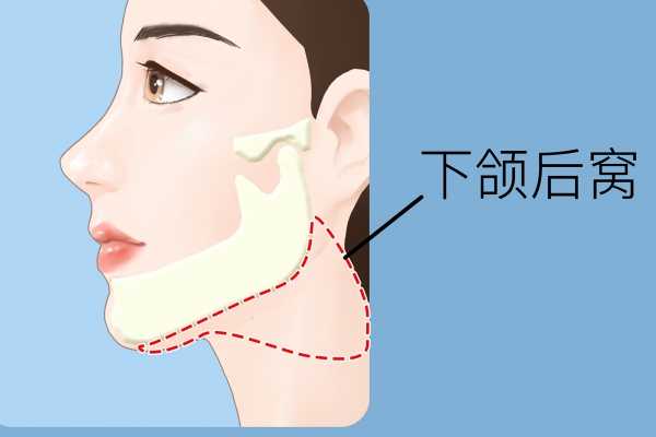 下颌线是哪个部位