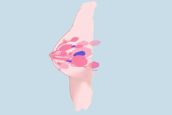 乳腺结节中医治疗最好的方法