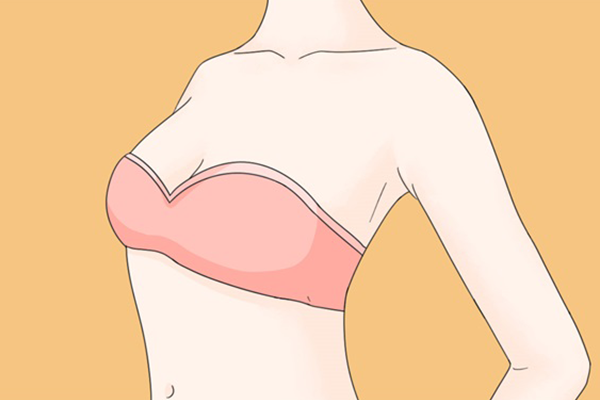 乳房悬吊棒棒糖手术方式