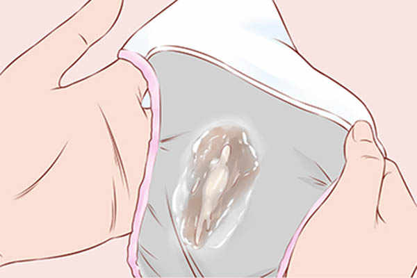 为什么有些女生下面会出白浆