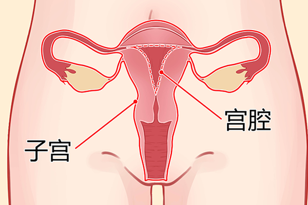 子宫暗区是什么意思
