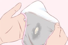 透明白带是什么原因 透明白带是排卵吗