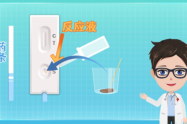精液常规检查有哪些
