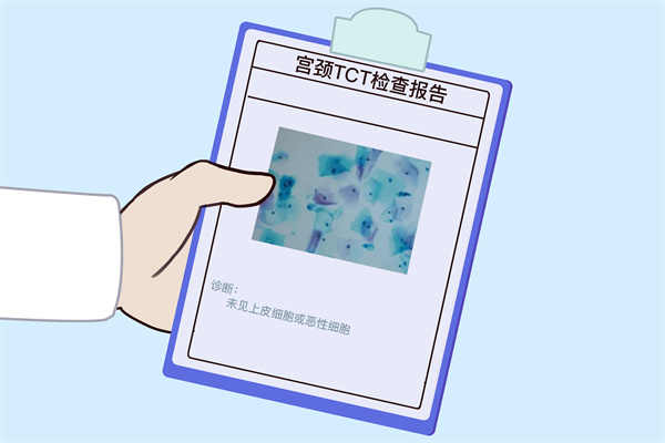 精液常规检查有哪些