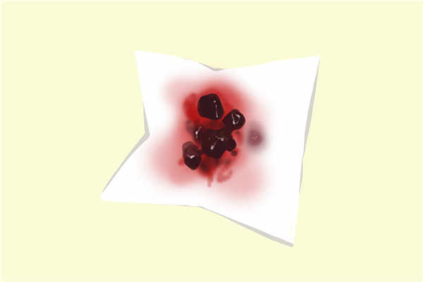 血府逐瘀胶囊能长期吃吗