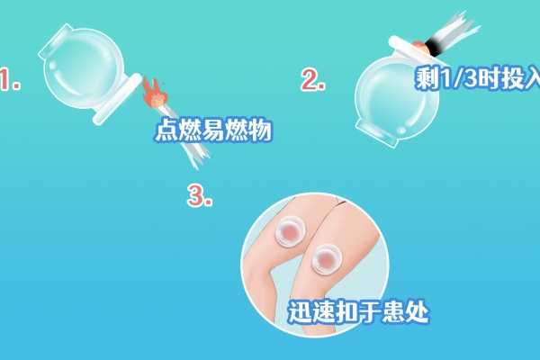 拔火罐的坏处