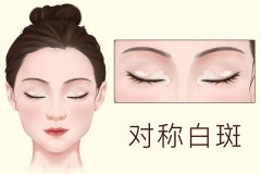 中医祛斑有效果吗 中医祛斑方法