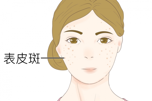 治疗祛斑哪家医院好