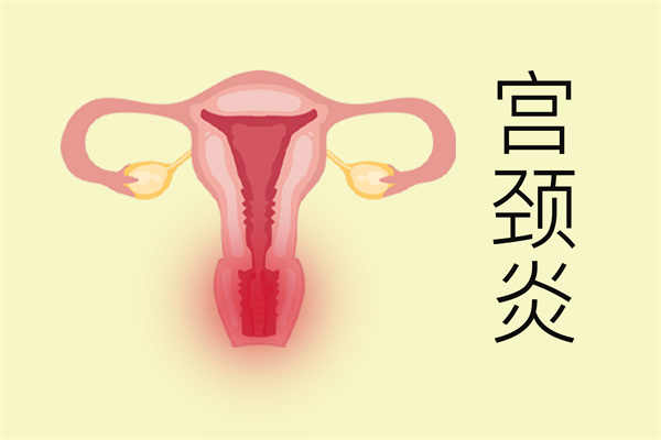 女性发烧然后下面有点血