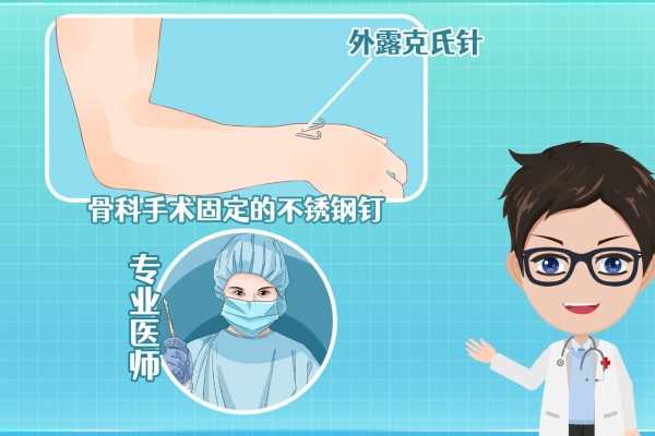 杭州骨科最好的医院排名