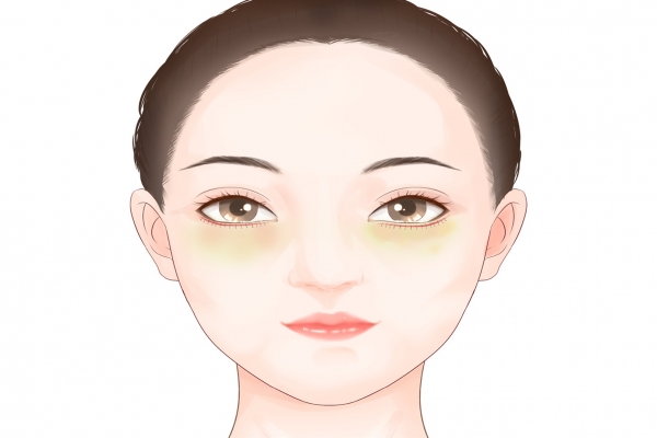 去眼袋的正规医院排行榜