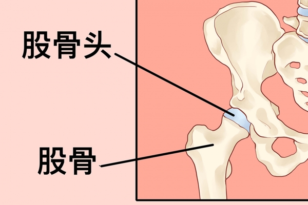治疗股骨头坏死哪家医院好