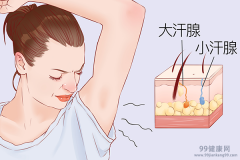 中药治疗狐臭的药有哪些 中药去狐臭的配方
