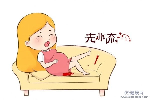 先兆流产有哪些征兆 先兆流产的