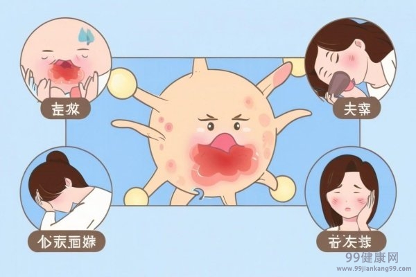 疱疹怎么引起的 疱疹的发病原因