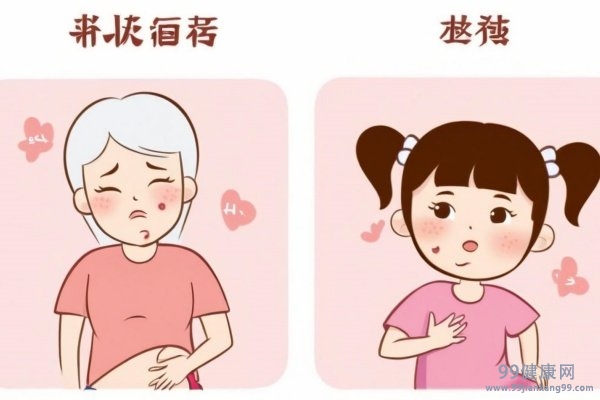 疱疹最快的治疗方法 疱疹治疗最