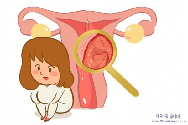 7种女人易患上宫颈癌 7种易患宫颈癌的女人包括哪种