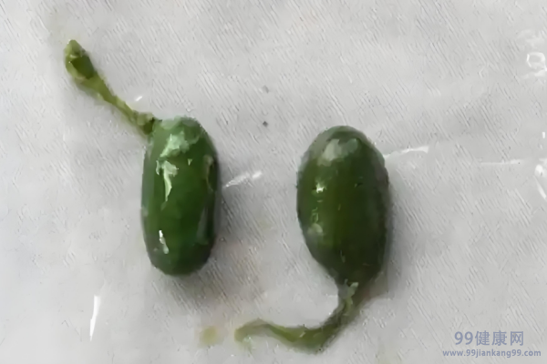 鱼胆的功效与作用 鱼胆中毒有什