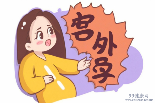 宫外孕症状早期 宫外孕早期怎么