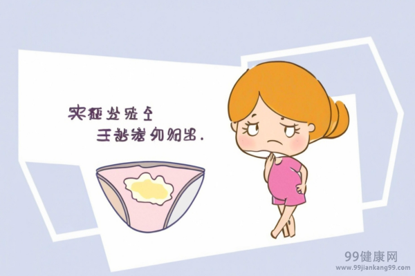 白带是什么 白带异常有哪些症状
