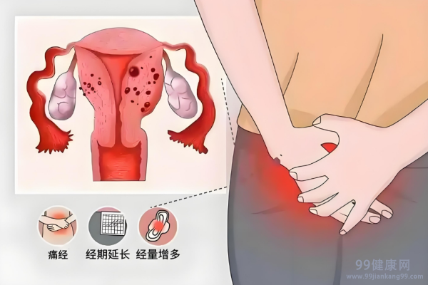 妇科疾病最爱找这四类人