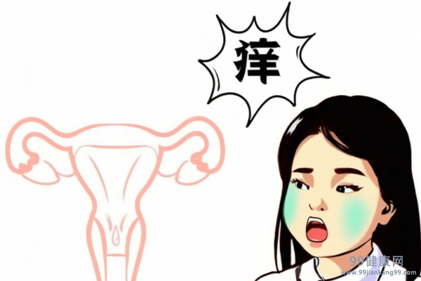 霉菌性阴炎怎么彻底好 霉菌性阴