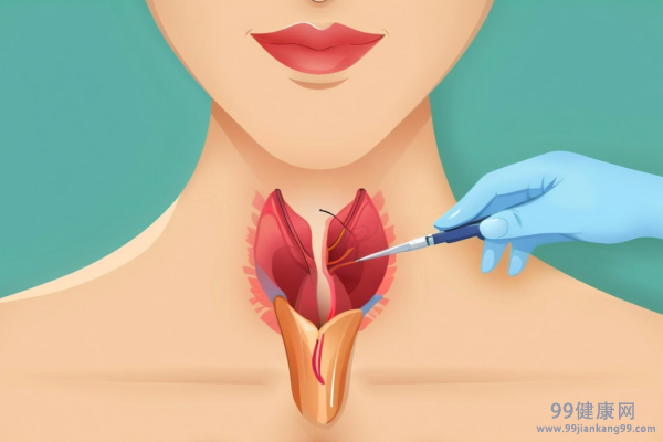 甲状腺3类结节严重吗 甲状腺3类结