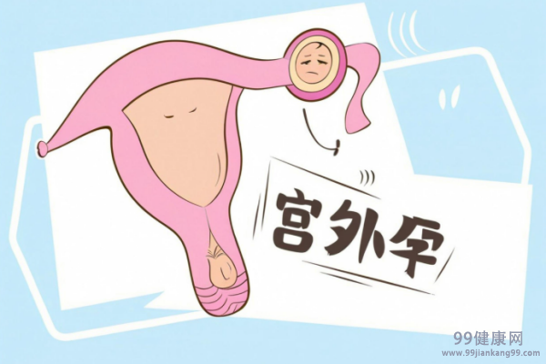 宫外孕会来月经吗 宫外孕会出血
